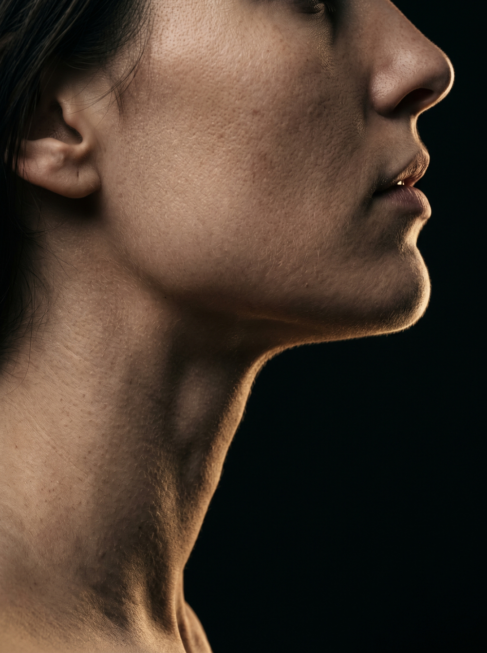 Definição de contorno mandibular